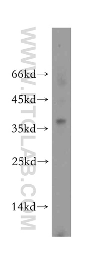 [18082-1-AP-150UL] PGLYRP3 Polyclonal antibody