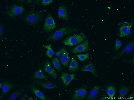 [18084-1-AP-150UL] Neurotrophin 3 Polyclonal antibody