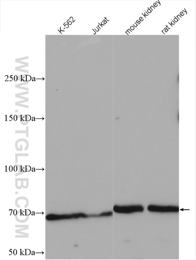[18085-1-AP-20UL] TEC Polyclonal antibody