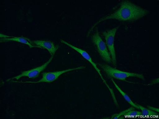 [18087-1-AP-20UL] MMP26 Polyclonal antibody