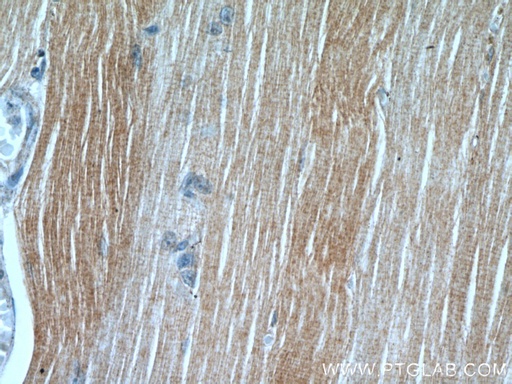 [18088-1-AP-20UL] PLA2G4E Polyclonal antibody
