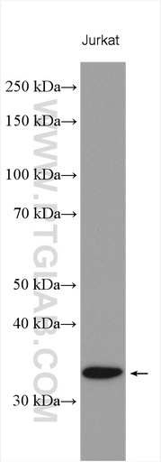 [18096-1-AP-20UL] CENPP Polyclonal antibody