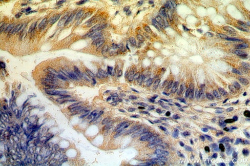 [18098-1-AP-20UL] B3GNT3 Polyclonal antibody