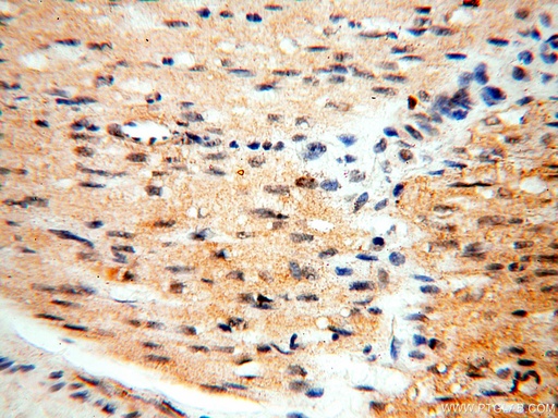 [18102-1-AP-150UL] SGCG Polyclonal antibody
