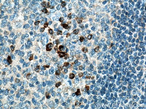 [18104-1-AP-20UL] IL-20 Polyclonal antibody