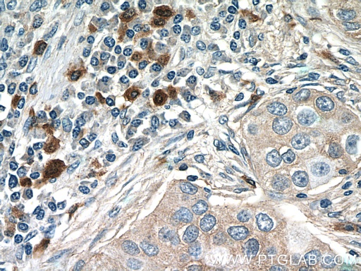 [18108-1-AP-150UL] CXCL17 Polyclonal antibody