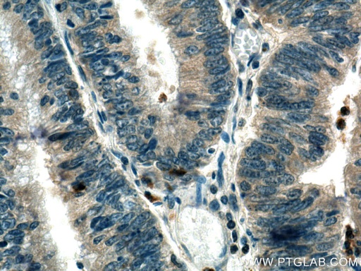[18110-1-AP-150UL] TRAF3IP3 Polyclonal antibody