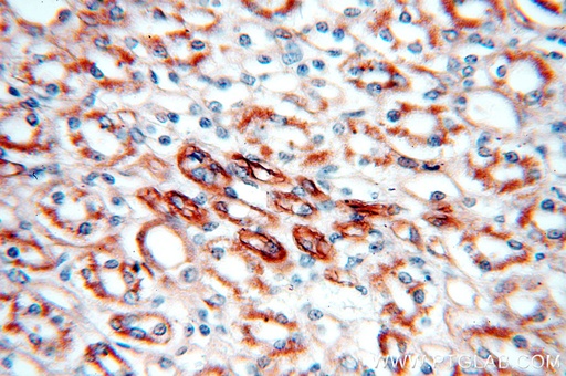 [18111-1-AP-150UL] KLHL20 Polyclonal antibody