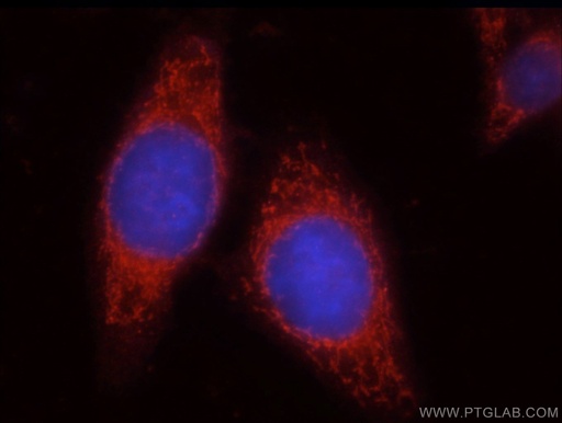 [18113-1-AP-150UL] Uroguanylin Polyclonal antibody