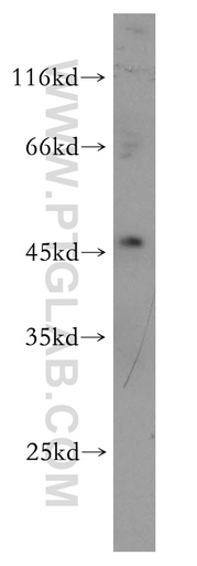 [18115-1-AP-20UL] Synaptotagmin-13 Polyclonal antibody