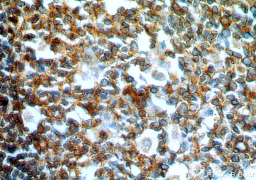 [18118-1-AP-20UL] GCNT2 Polyclonal antibody