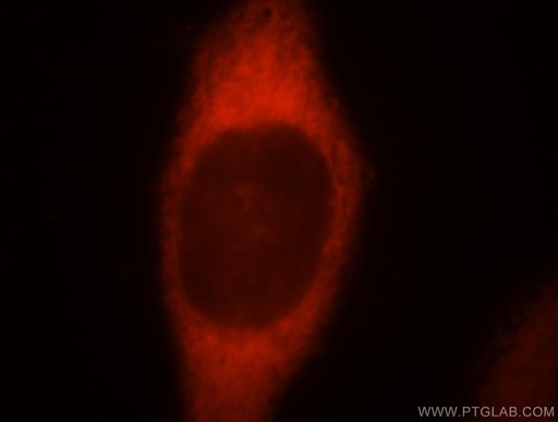 [18121-1-AP-20UL] FARSA Polyclonal antibody