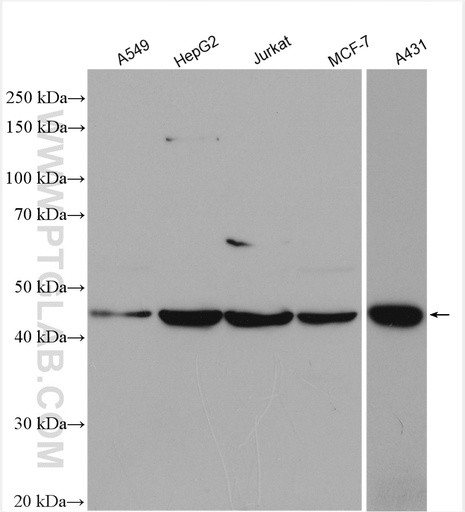 [18126-1-AP-150UL] PARP15 Polyclonal antibody