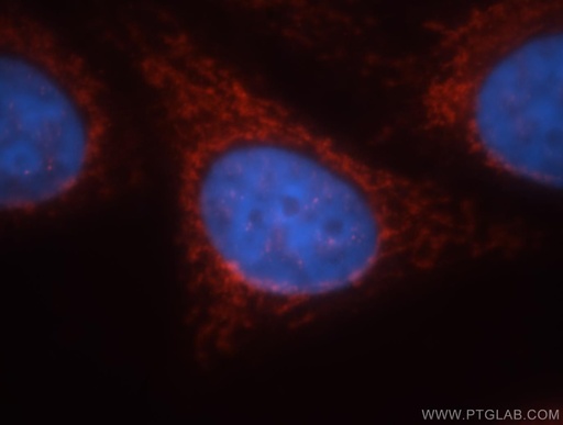 [18129-1-AP-20UL] GCOM1 Polyclonal antibody