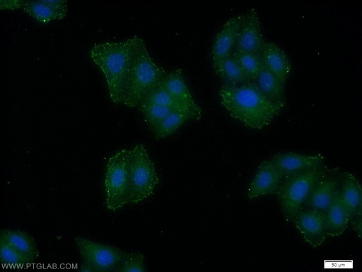 [18131-1-AP-20UL] Kindlin 3 Polyclonal antibody