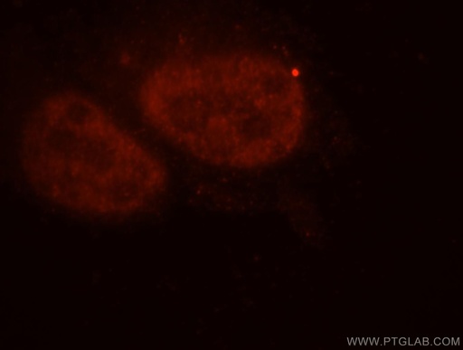 [18137-1-AP-20UL] Importin Alpha 5 Polyclonal antibody