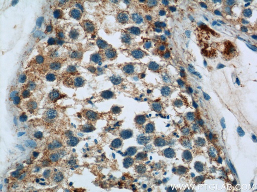 [18139-1-AP-20UL] HYAL4 Polyclonal antibody