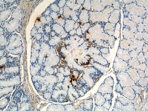 [18143-1-AP-20UL] Gastrin Polyclonal antibody