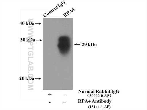 [18144-1-AP-150UL] RPA4 Polyclonal antibody