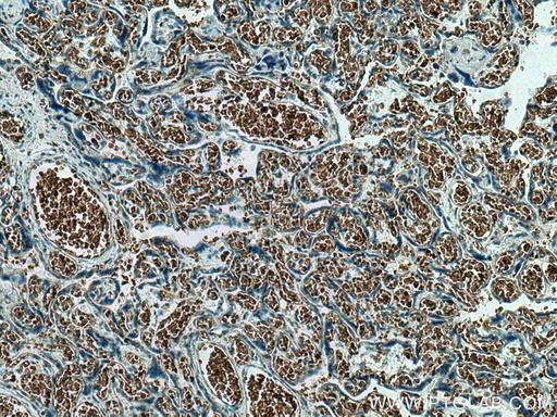 [18147-1-AP-150UL] GYPC Polyclonal antibody
