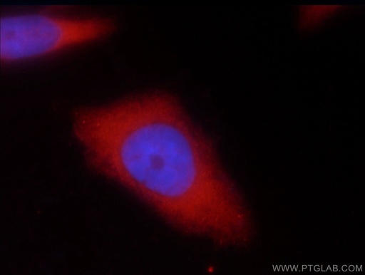 [18148-1-AP-20UL] UBE4B Polyclonal antibody