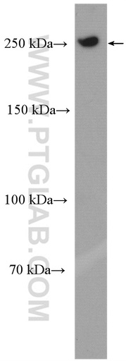 [20655-1-AP-20UL] POLR2A Polyclonal antibody