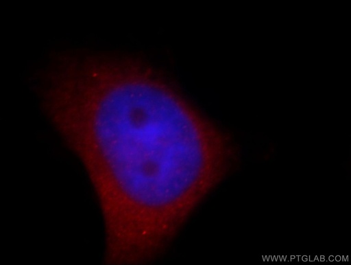 [20656-1-AP-20UL] NPTX1 Polyclonal antibody