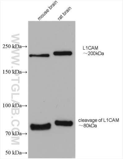 [20659-1-AP-150UL] L1CAM Polyclonal antibody