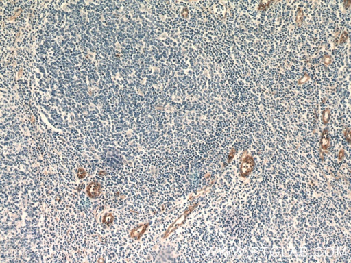 [20663-1-AP-20UL] Stabilin-1 Polyclonal antibody