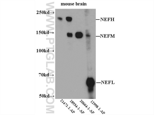 [20664-1-AP-20UL] NF-M-Specific Polyclonal antibody