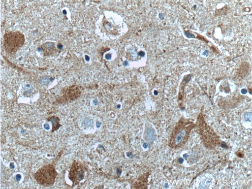 [20667-1-AP-20UL] CaMKII delta-Specific Polyclonal antibody