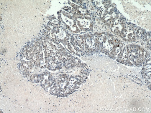 [20672-1-AP-20UL] CTR9 Polyclonal antibody