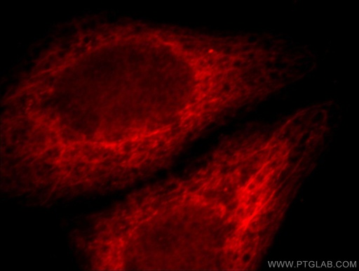 [20673-1-AP-20UL] IL-17RB Polyclonal antibody