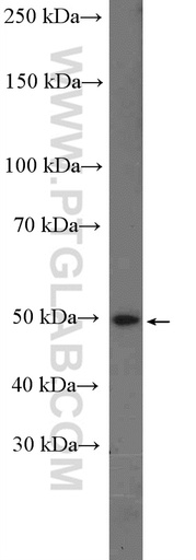 [20676-1-AP-20UL] SLC16A2 Polyclonal antibody