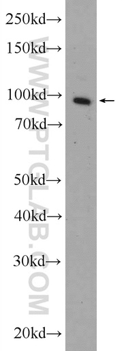 [20679-1-AP-150UL] Transportin-1 Polyclonal antibody