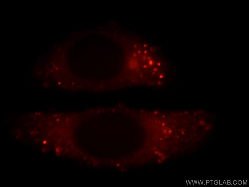 [20685-1-AP-150UL] FLNB Polyclonal antibody
