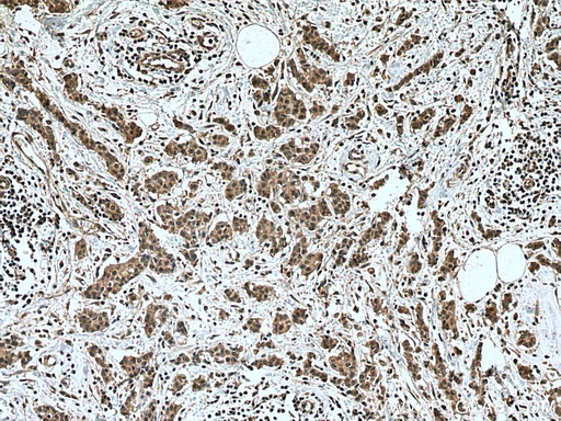 [20687-1-AP-150UL] NOTCH1 Polyclonal antibody