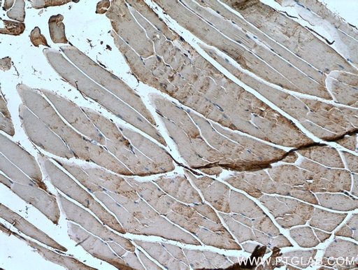 [20702-1-AP-20UL] IRS2 Polyclonal antibody