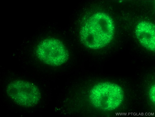 [20705-1-AP-20UL] TOP1 Polyclonal antibody
