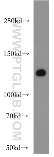 [20712-1-AP-150UL] VEGFR3 Polyclonal antibody