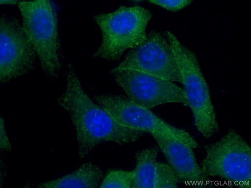 [20713-1-AP-20UL] GHR Polyclonal antibody