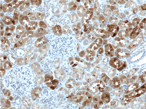 [20715-1-AP-20UL] GHRHR Polyclonal antibody
