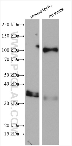 [20717-1-AP-150UL] ESPN Polyclonal antibody