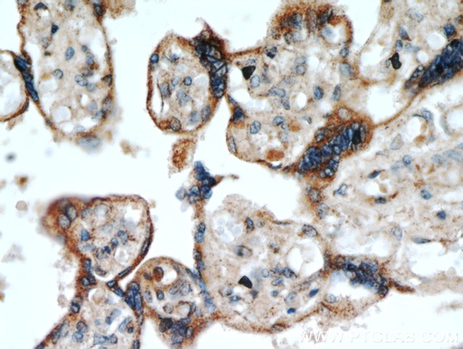 [20718-1-AP-20UL] TMC1 Polyclonal antibody