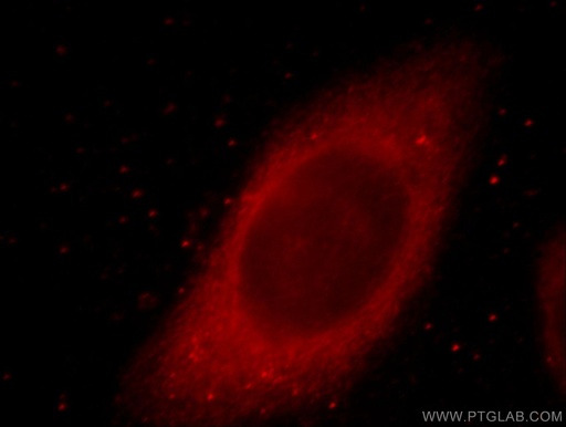 [20720-1-AP-20UL] MYO7A Polyclonal antibody