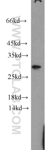 [20724-1-AP-150UL] Claudin 22 Polyclonal antibody