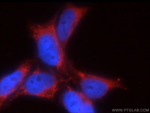 [20728-1-AP-20UL] GNRHR2 Polyclonal antibody
