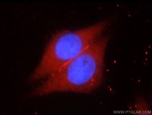 [20735-1-AP-20UL] SYNM Polyclonal antibody