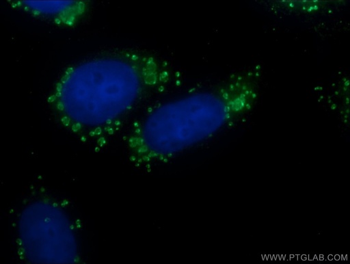 [20738-1-AP-20UL] CFTR Polyclonal antibody