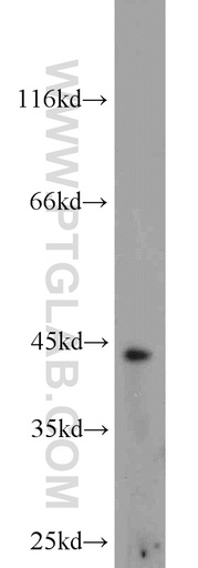 [20741-1-AP-20UL] Brachyury-T Polyclonal antibody